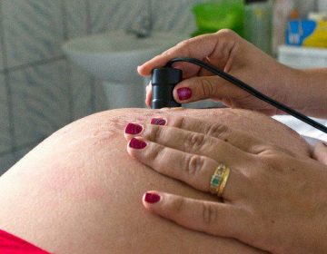 STF julga ADI do aborto de feto com zika